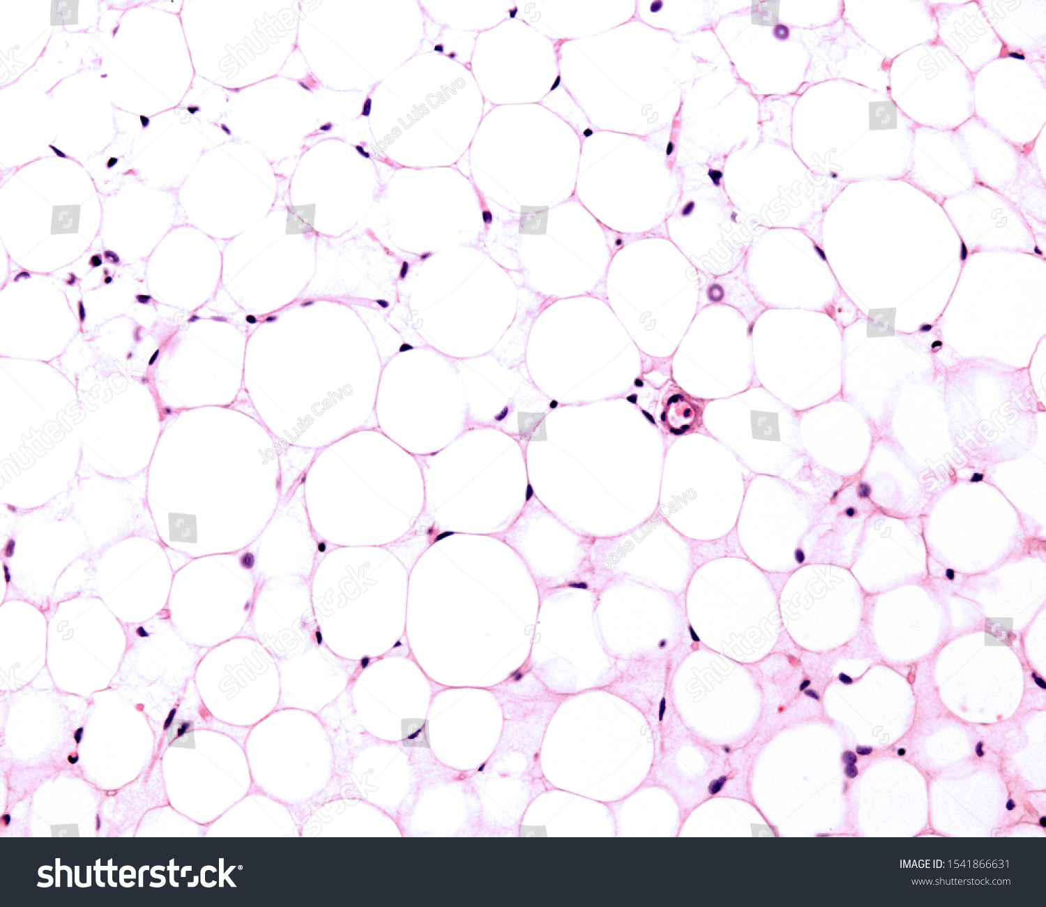 White adipose tissue stained with HE. Adipocytes (fat cells) contains a large lipid droplet surrounded by a thin layer of cytoplasm. The nucleus is flattened and located on the periphery #1541866631