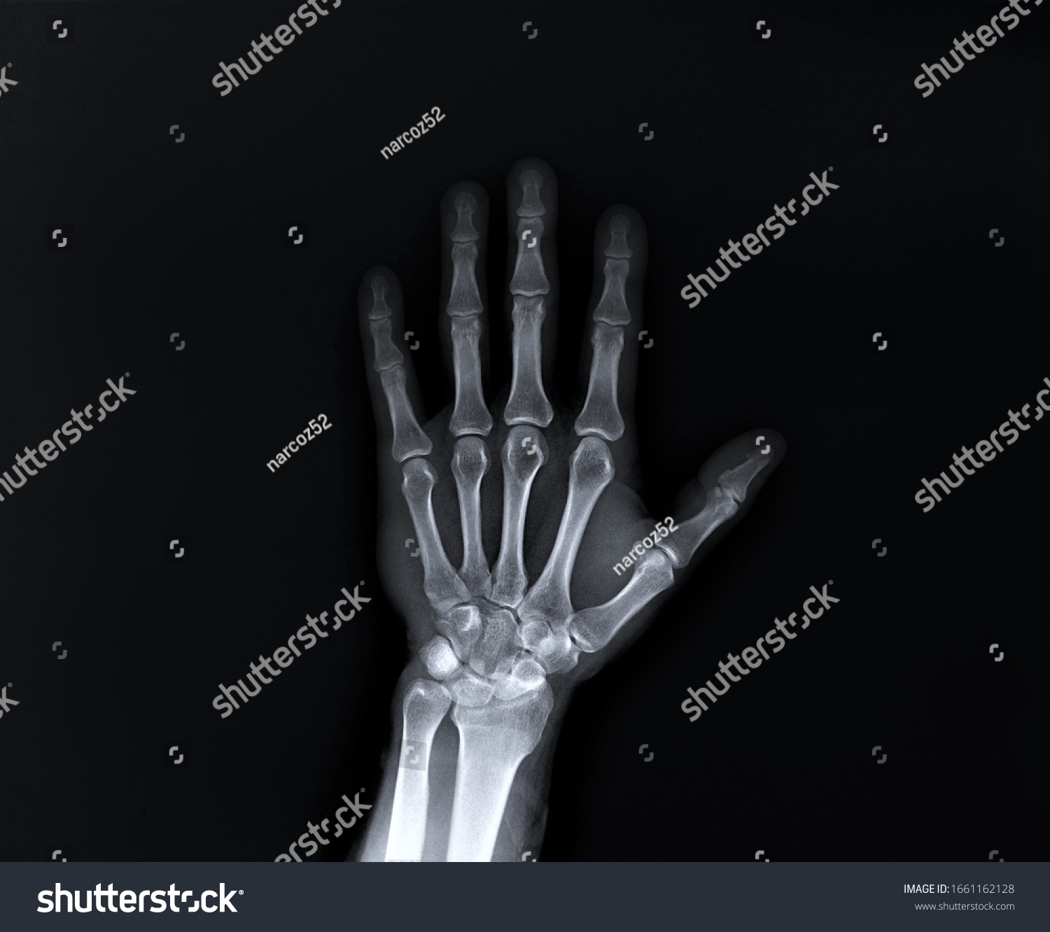 x-ray of the hand and wrist bones #1661162128