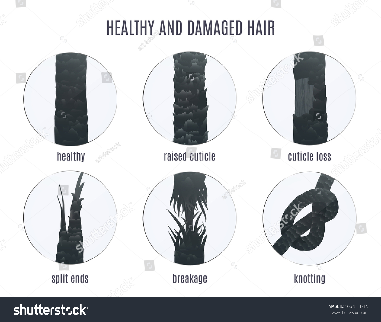 Damaged hair surface under microscope. Hair follicle structure condition closeup vector set. Problem of split ends, breakage, knotting, raised cuticle and loss of cuticle. Trichology medical concept.  #1667814715
