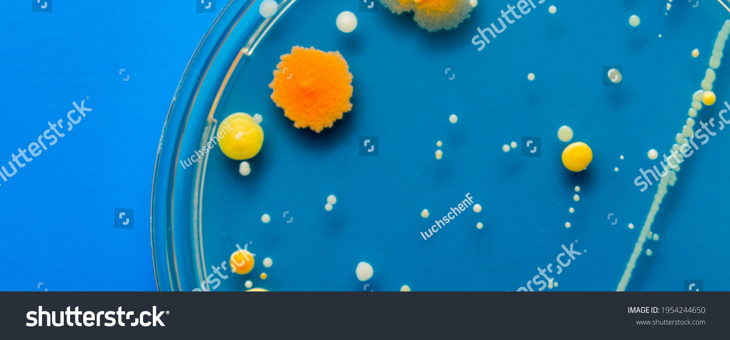 Yellow and orange Bacterial colonies on agar agar substrate in petri dish plate on blue background #1954244650