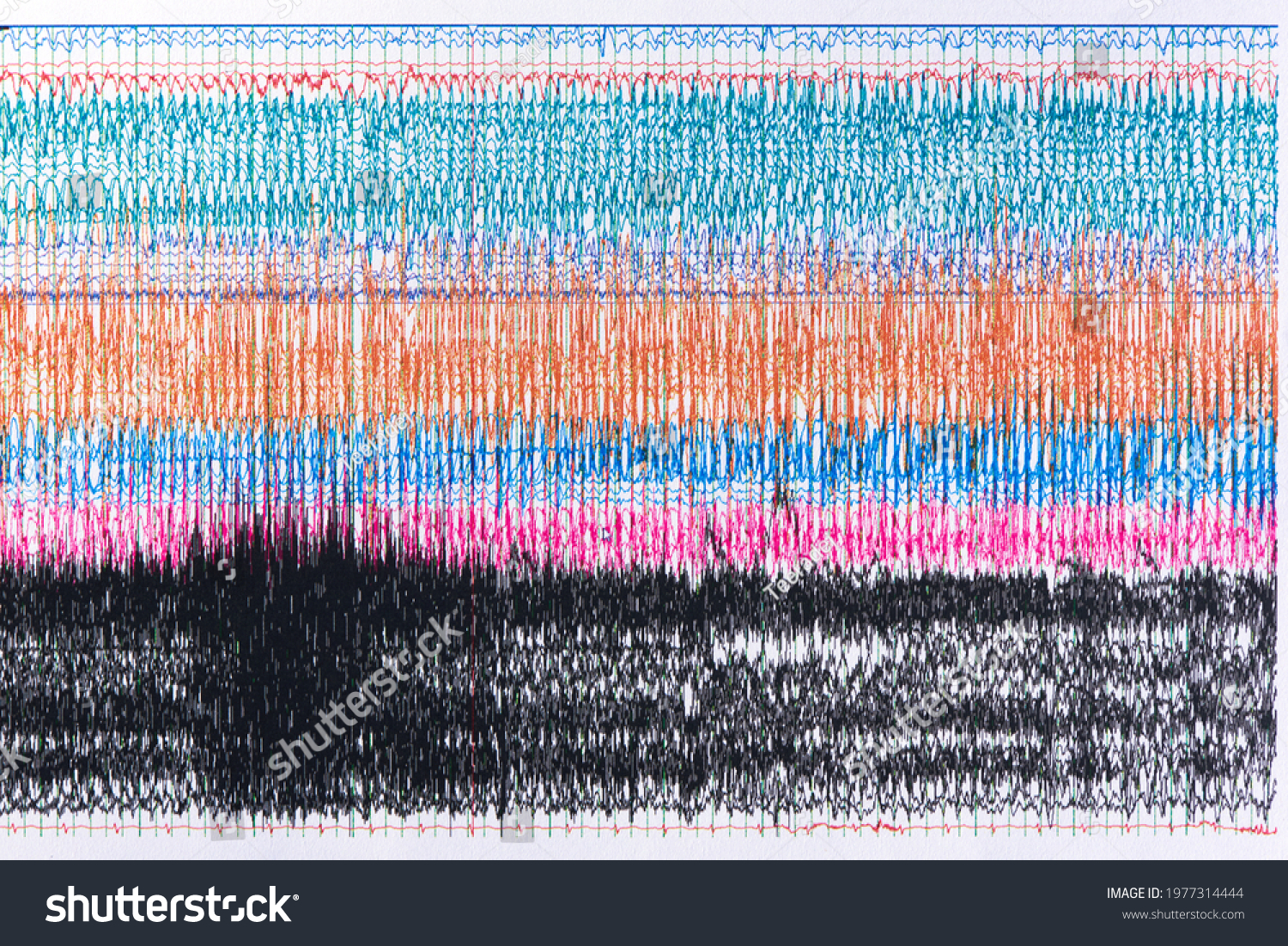 Photograph of brain waves during seizure.or ictal EEG  Seizure waves showing high amplitudes and high frequency. #1977314444
