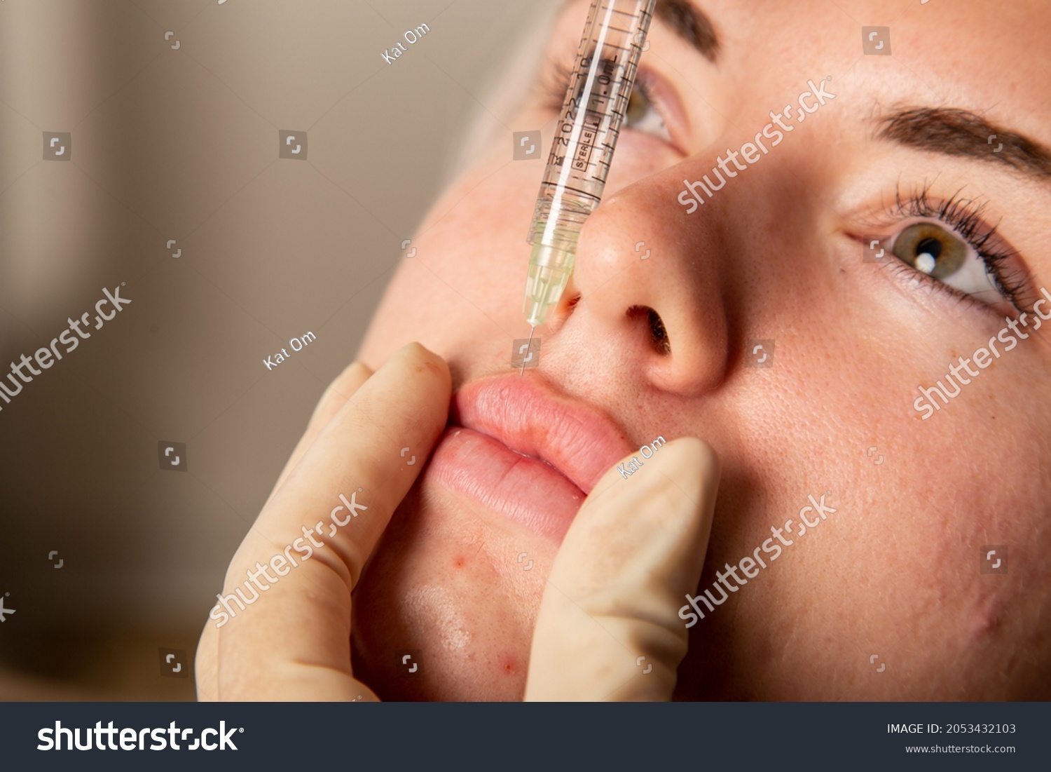 
Young beautiful caucasian woman receiving esthetic injections. Lip filler beauty procedures. Plump lips, russian lips, derma injections, full lips.  #2053432103