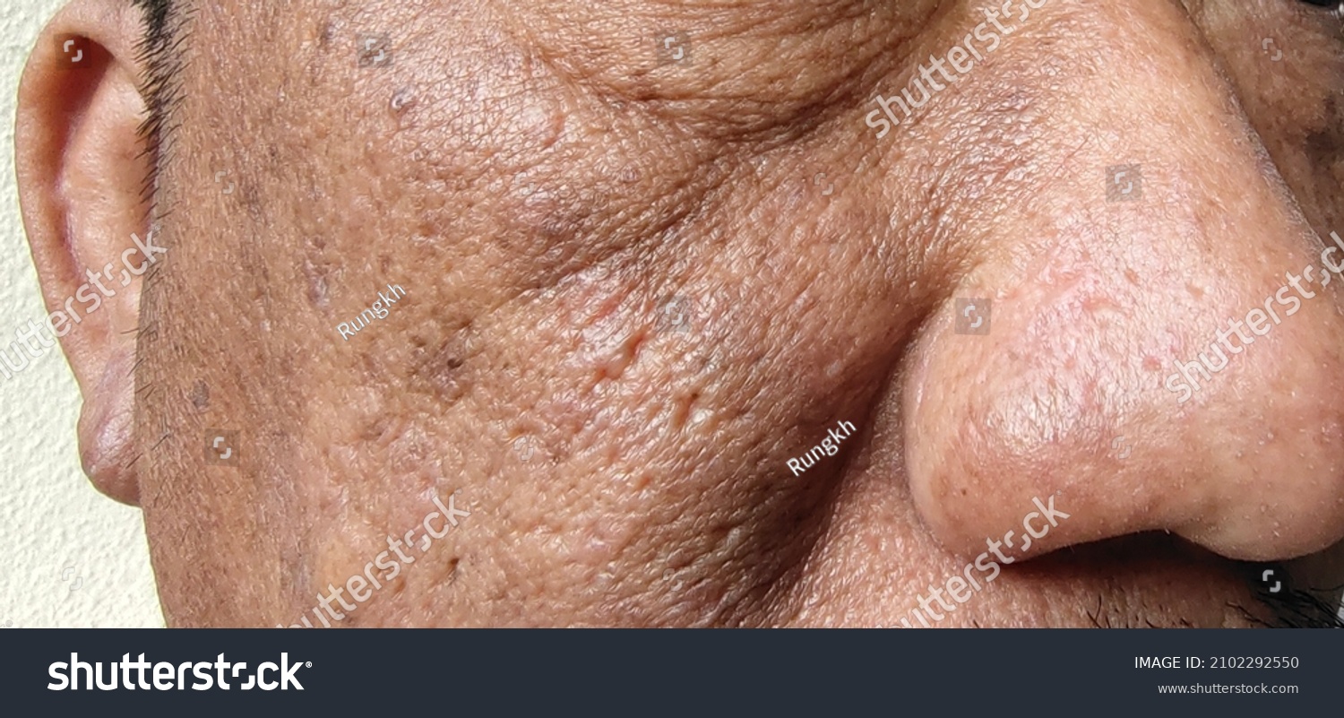portrait dull face and rough skin of Middle-aged man, problem skin care, cellulite and pimple under the eyes. #2102292550