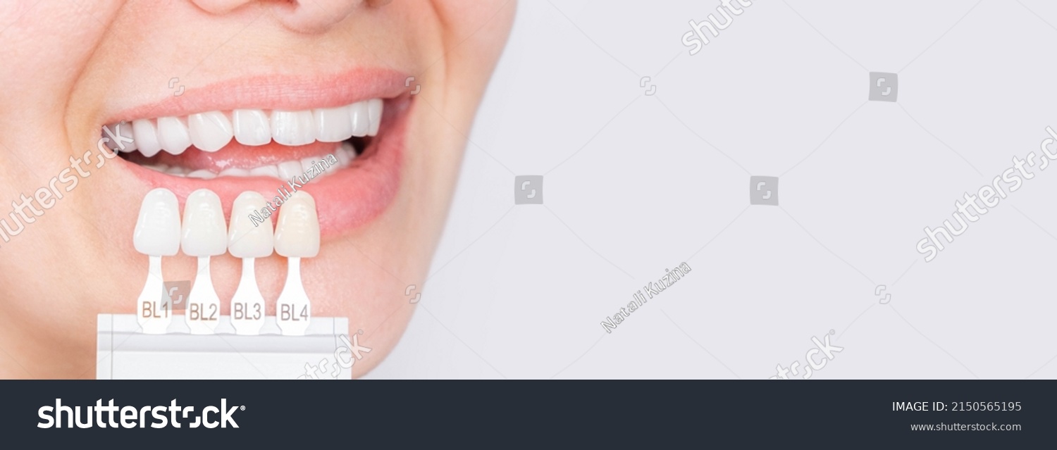 Banner tooth whitening, perfect white crown teeth close up with shade guide bleach color, female veneer smile, dental care and stomatology, dentistry, copyspace. #2150565195