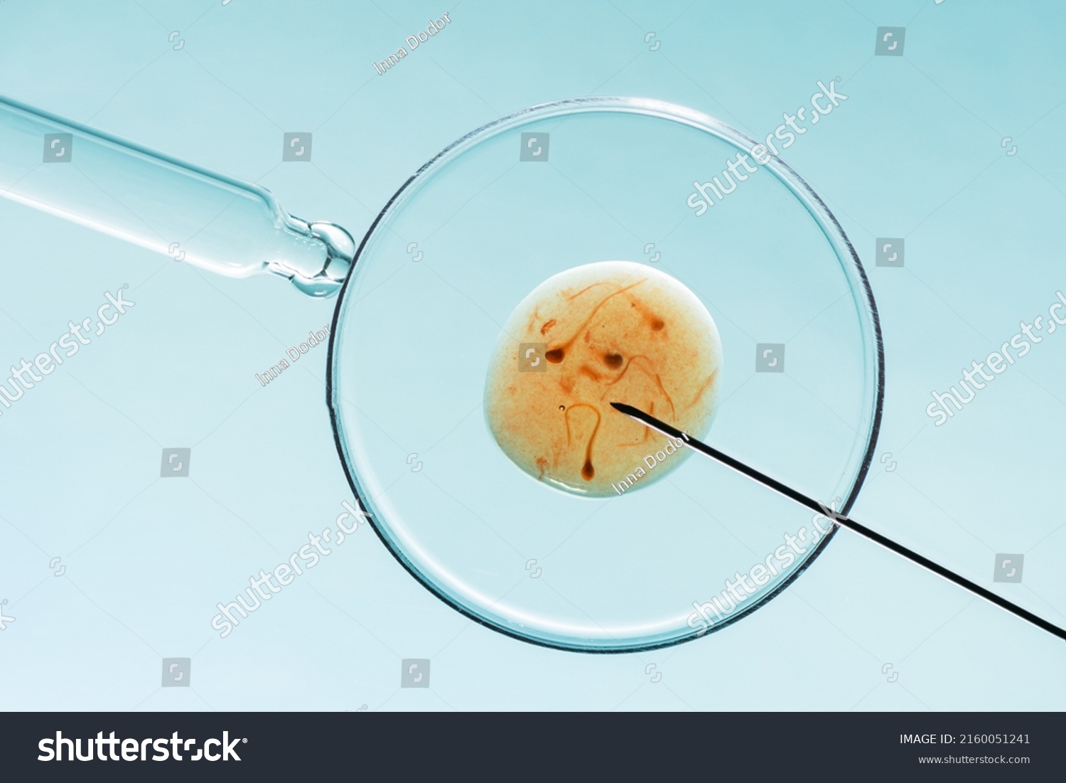In vitro fertilisation concept. Artificial insemination or fertility treatment macro photography.  #2160051241