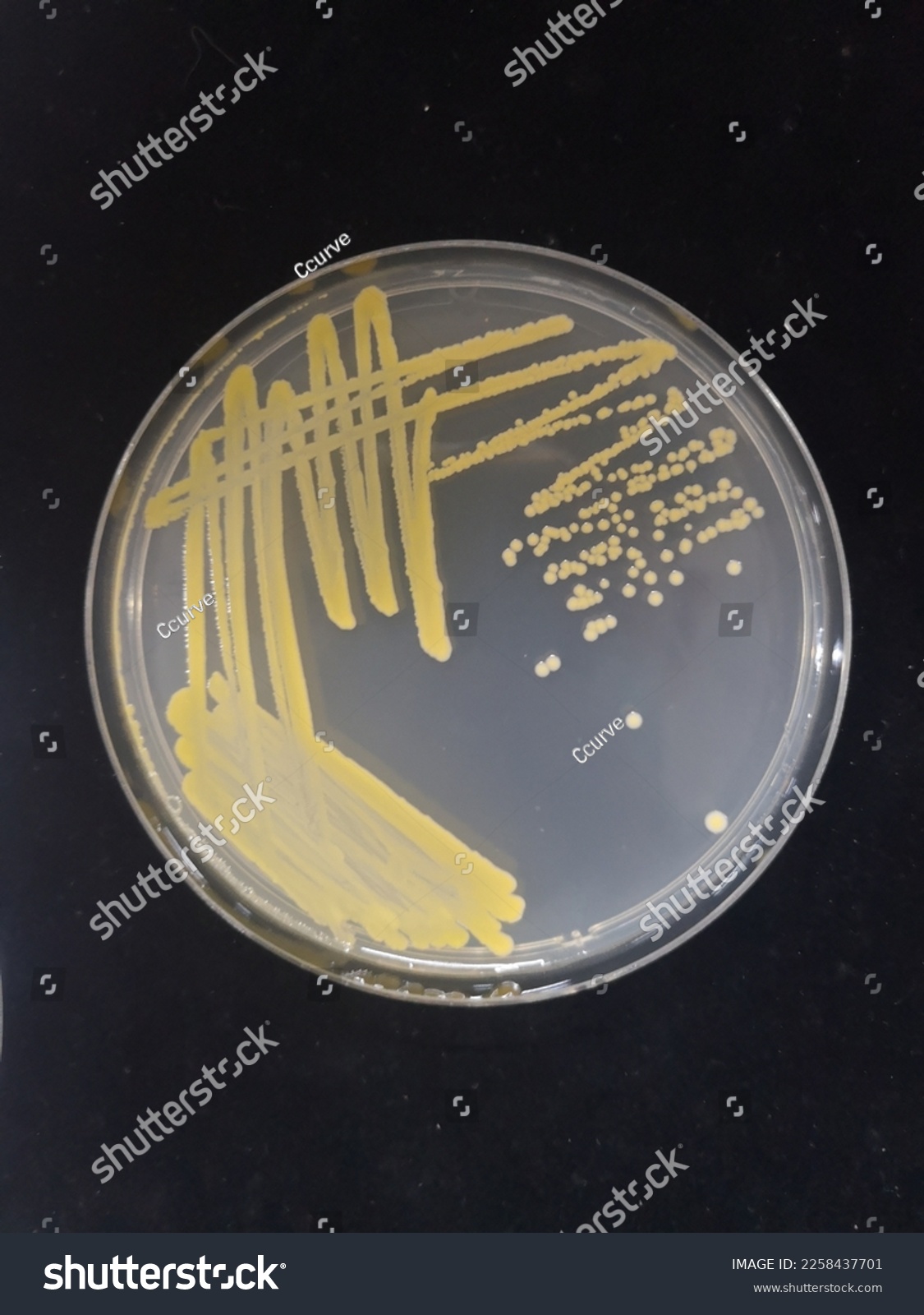 Staphylococcus aureus is a Gram-positive spherically shaped bacterium, a member of the Bacillota, and is a usual member of the microbiota of the body, frequently found in the upper respiratory tract  #2258437701