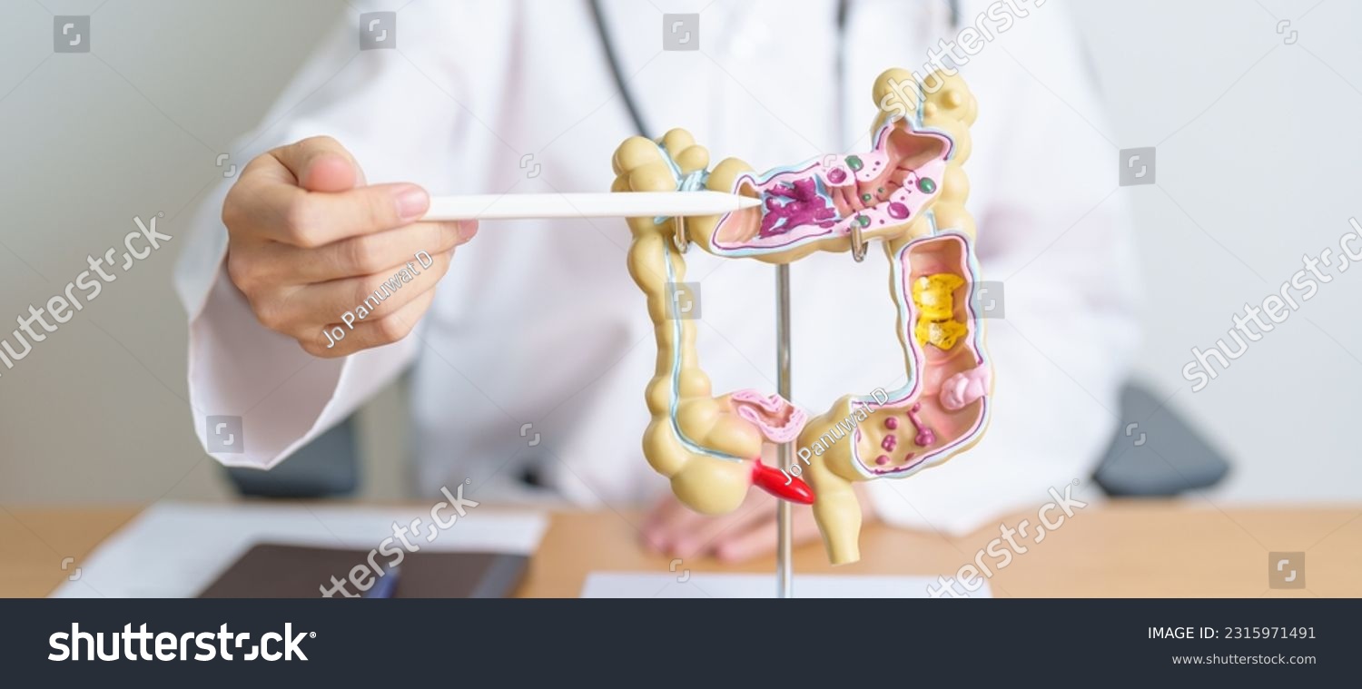 Doctor with human Colon anatomy model. Colonic disease, Large Intestine, Colorectal cancer, Ulcerative colitis, Diverticulitis, Irritable bowel syndrome, Digestive system and Health concept #2315971491