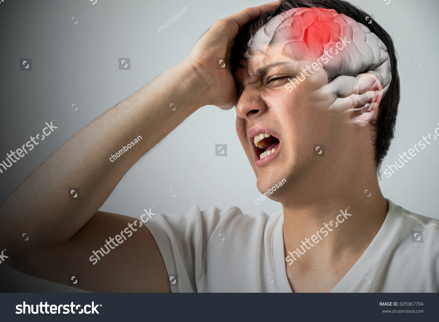 brain stroke concept, headache, cerebral hemorrhage, 3D rendering #605967794