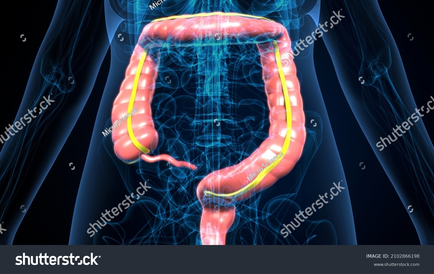 3d Illustration Human Large Intestine Anatomy Stock Illustration 2102866198 6244