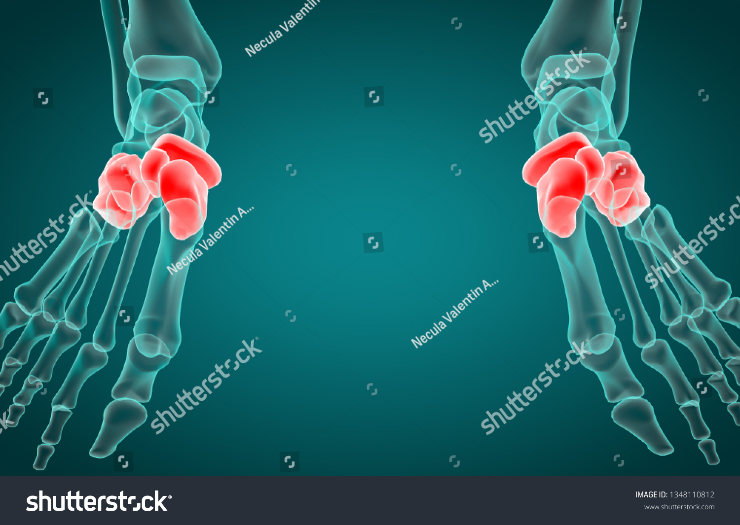 3d Illustration Tarsal Bone Xray Stock Illustration 1348110812