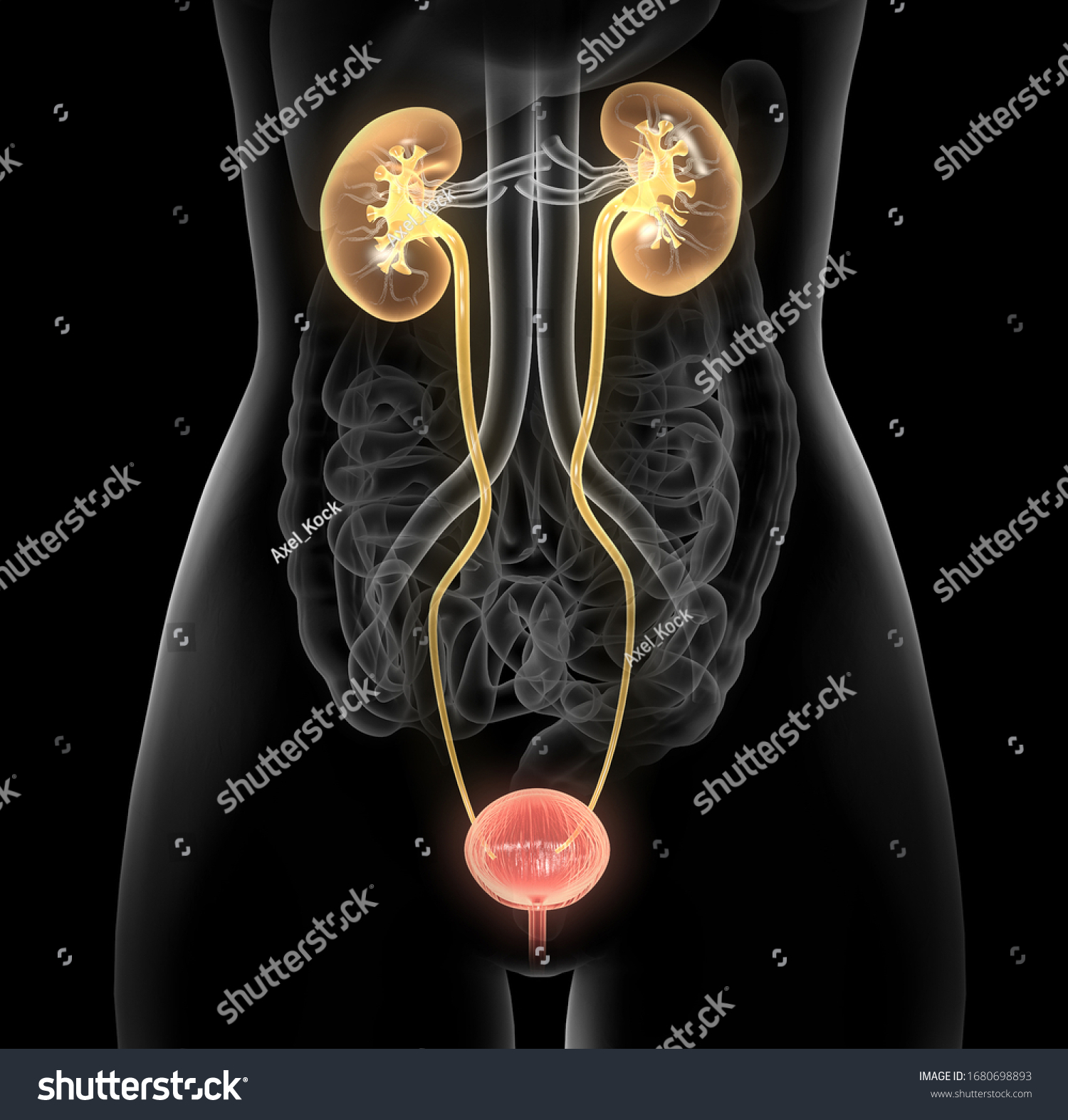 3d Illustration Showing Bladder Infection Urinaty Stock Illustration 1680698893 Shutterstock 3789