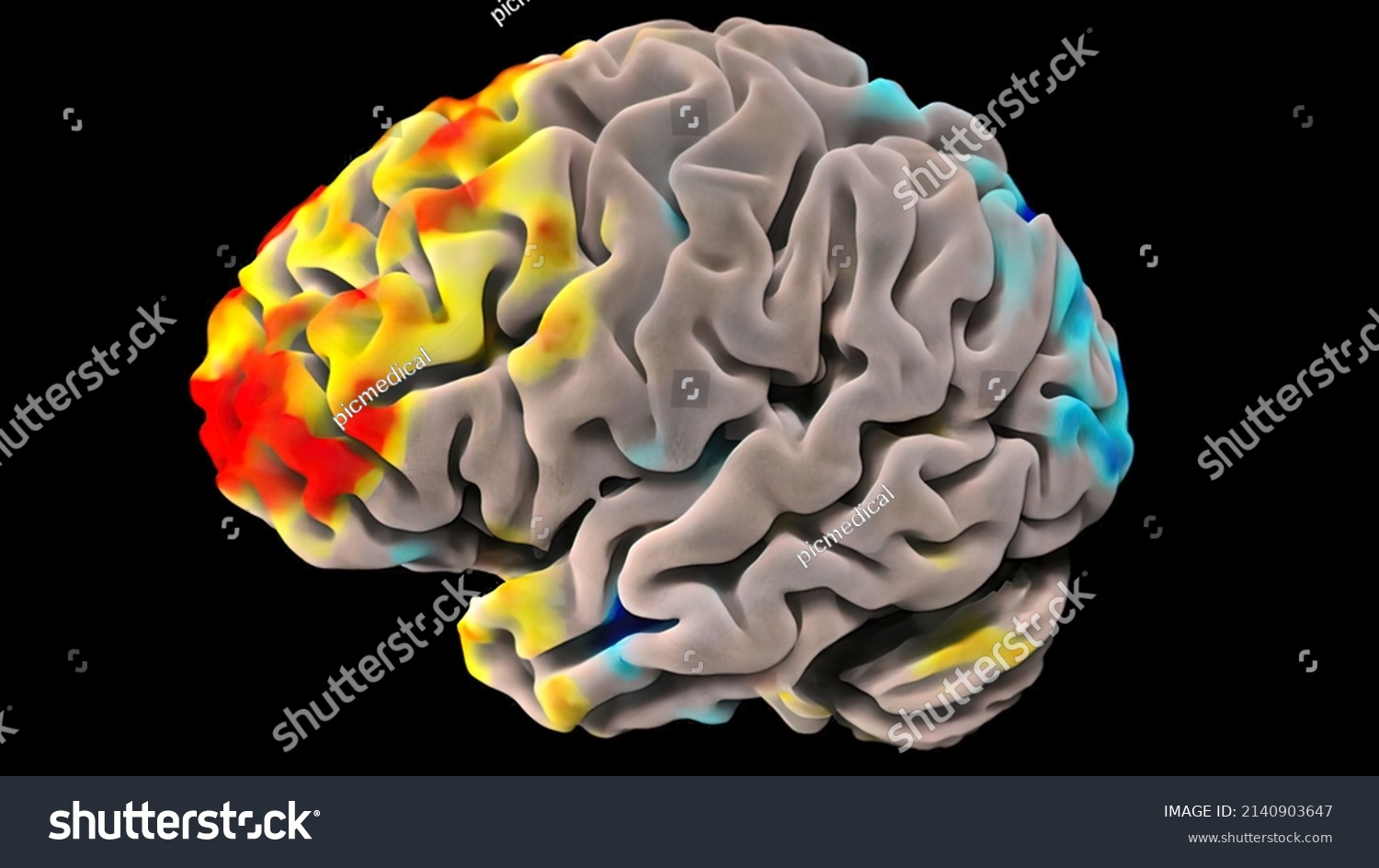 3d Medical 3d Illustration Human Brain Stock Illustration 2140903647 ...