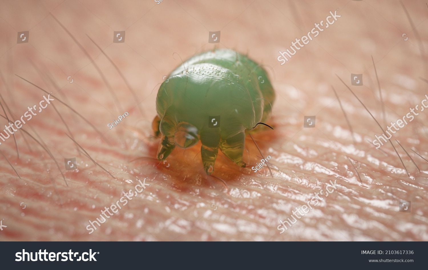 1-517-itch-mite-images-stock-photos-vectors-shutterstock