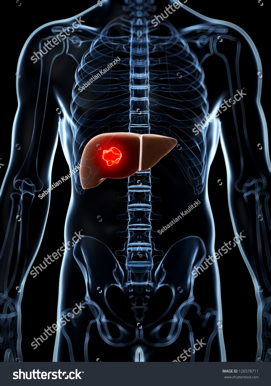 3d Rendered Illustration Of The Male Liver - 126578711 : Shutterstock
