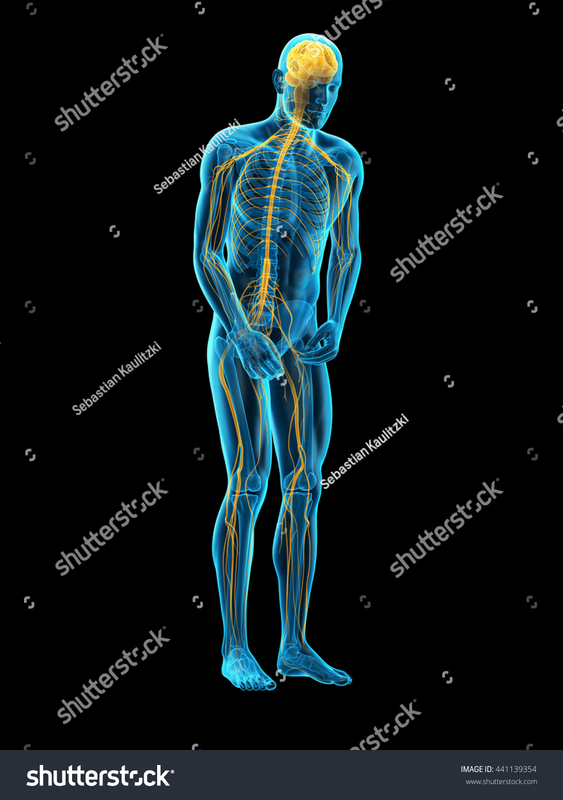 3d Rendered, Medically Accurate 3d Illustration Of Parkinson ...