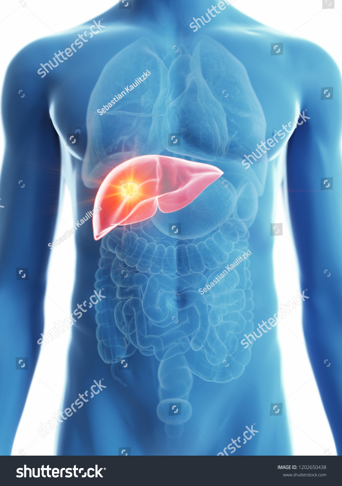 3d Rendered Medically Accurate Illustration Mans Stock Illustration