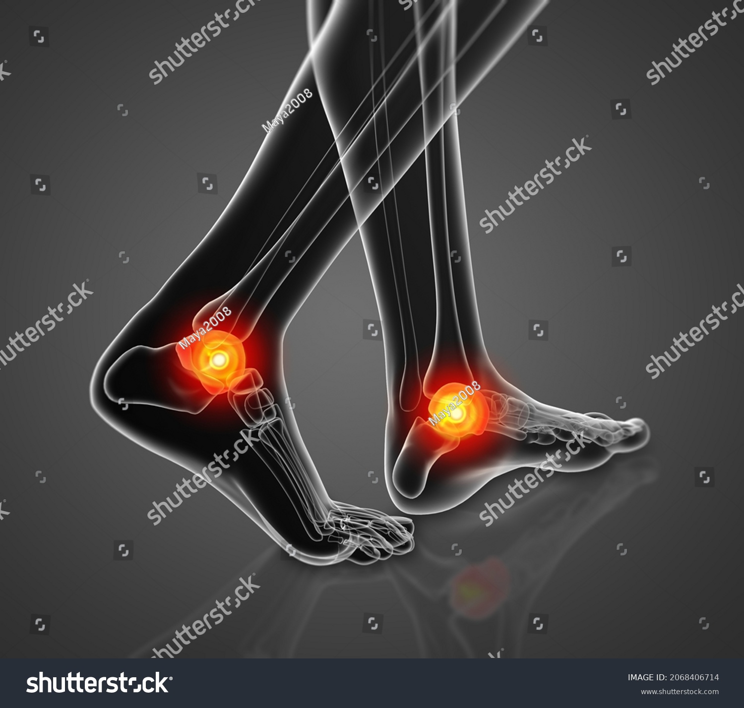 3d Rendering Illustration Talus Bone Side Stock Illustration 2068406714 Shutterstock 5972