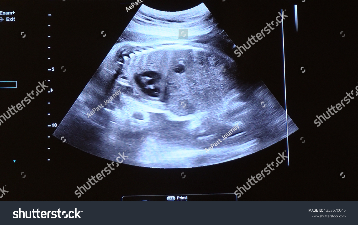 2d Ultrasound Display 28 Weeks Pregnant Stock Photo 1353670046