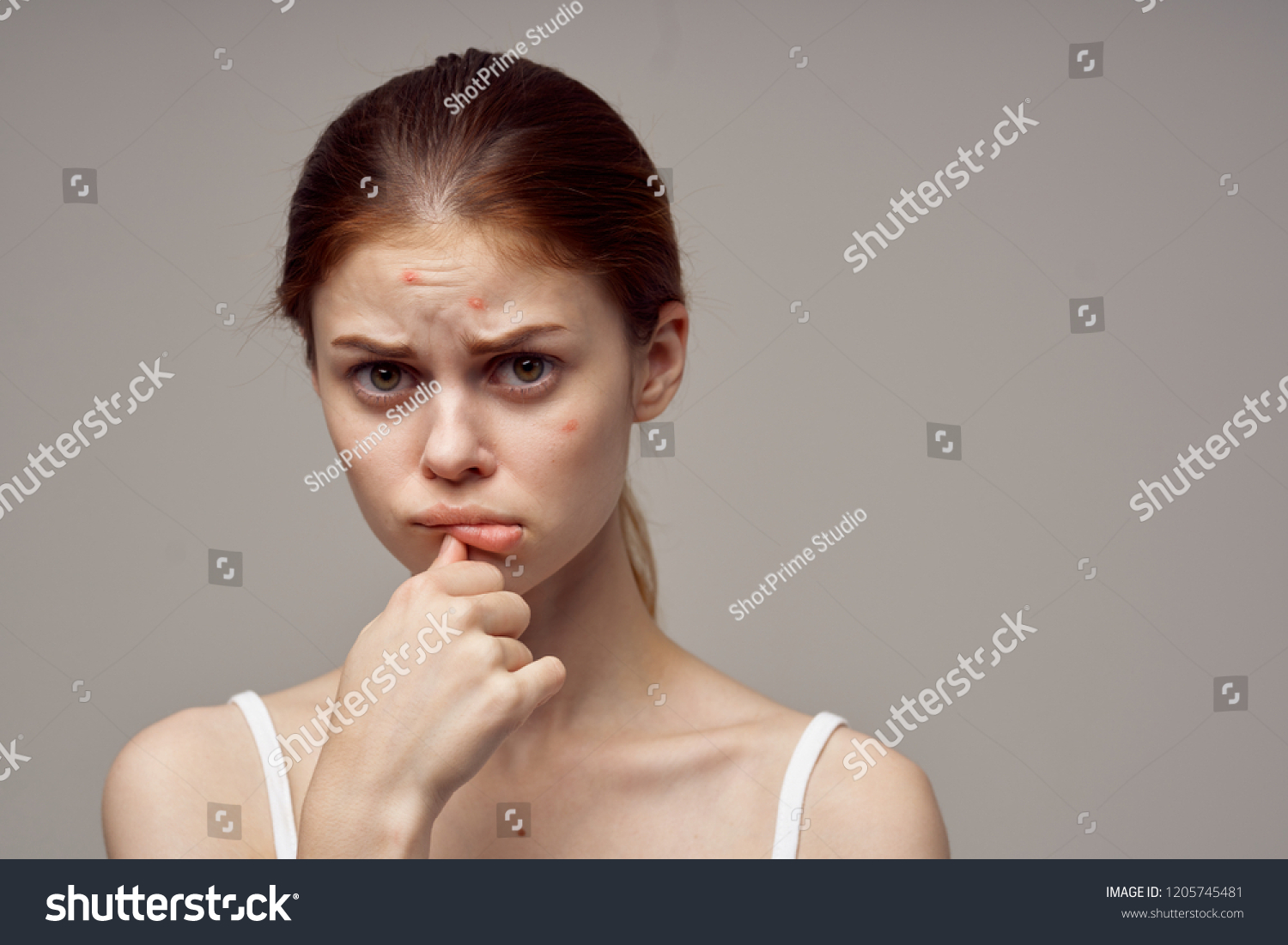 Facial furrowed spot Adult pics Facial furrowed spot