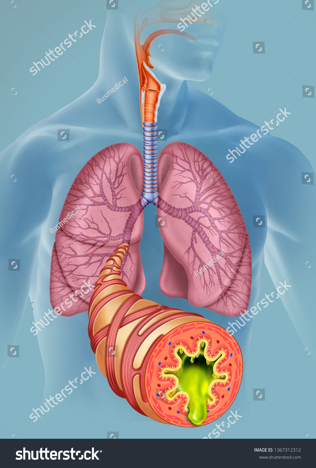 90 Excessive mucus Images, Stock Photos & Vectors | Shutterstock