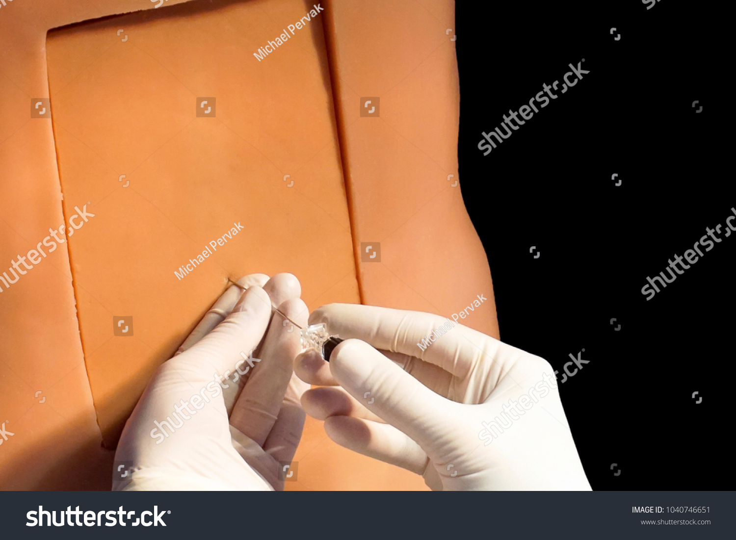 Lumbar Puncture Epidural Anesthesia Procedure Technique Foto De Stock