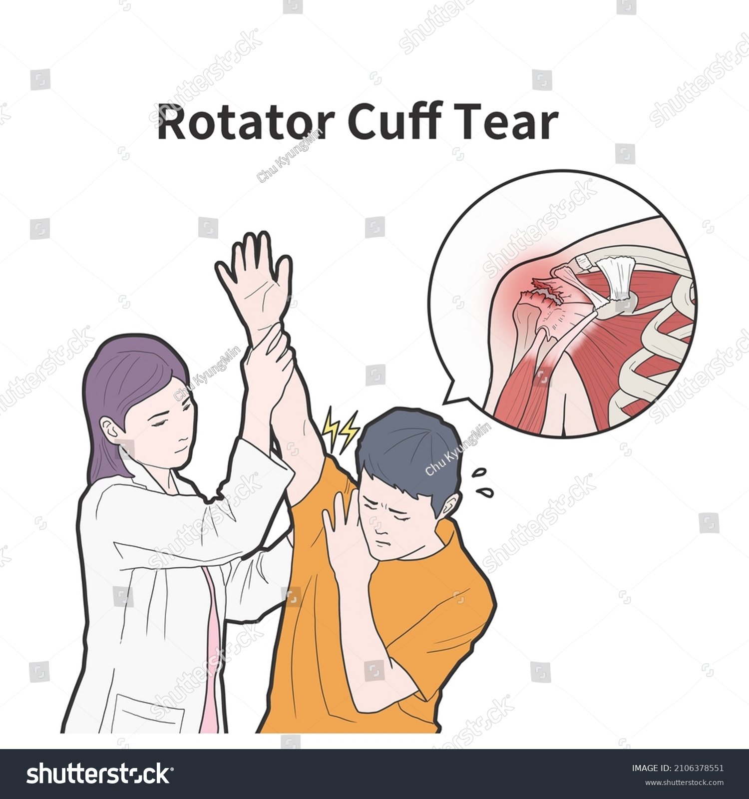 Medical Illustration Man Suffering Rotator Cuff Stock Illustration ...