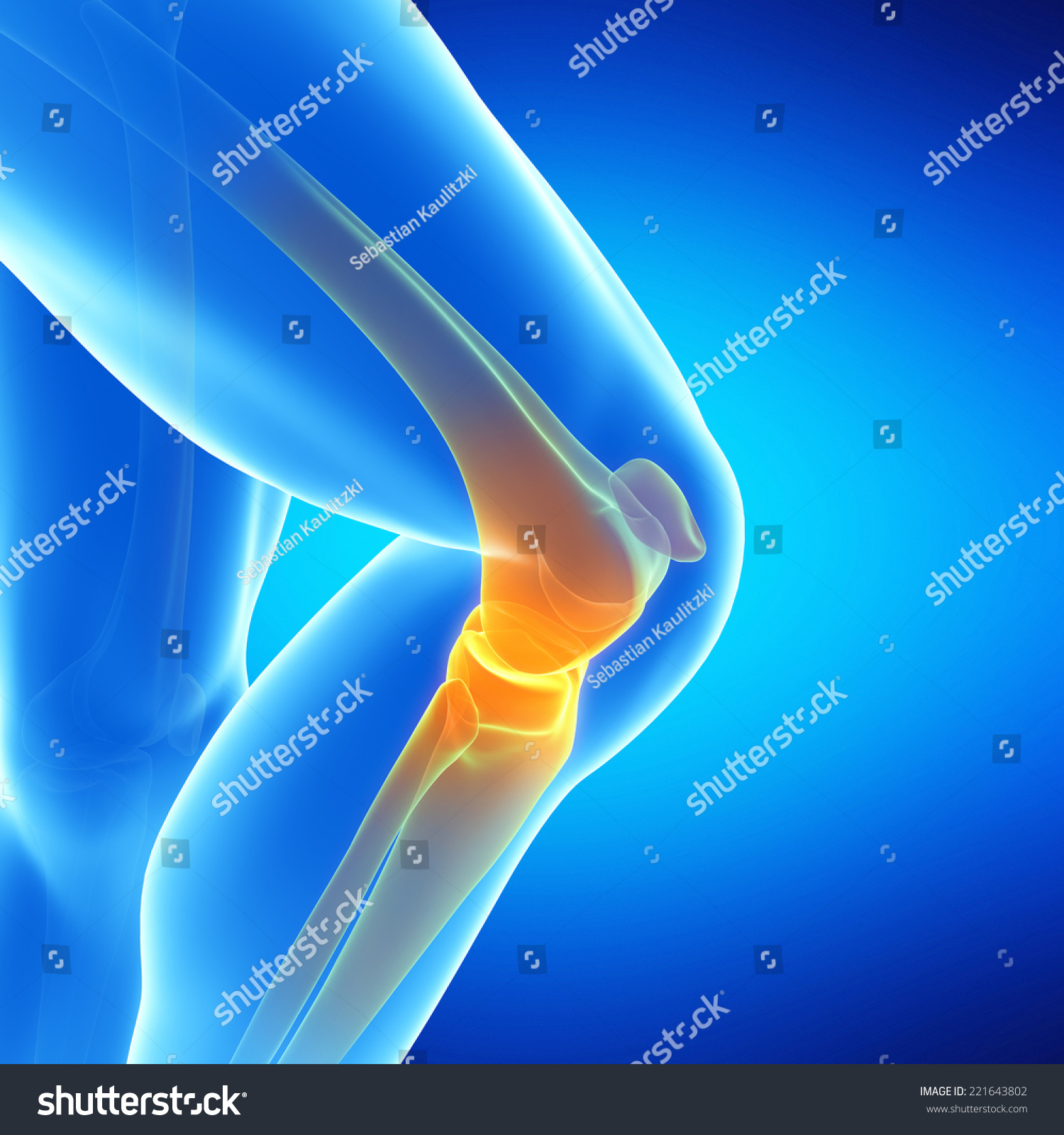 Medical Illustration Of The Knee Joint - 221643802 : Shutterstock