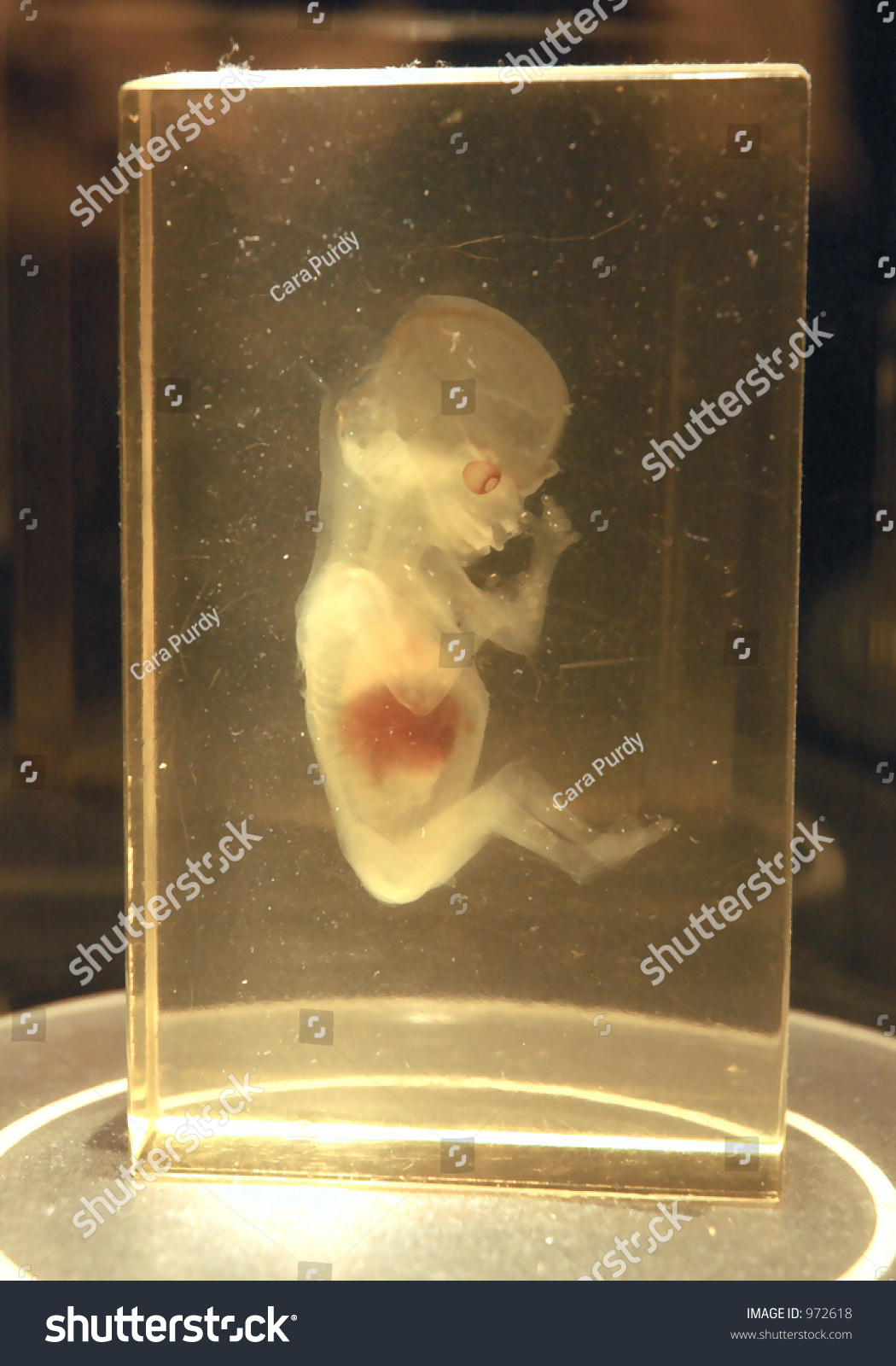 3 Month Old Fetus Stock Photo 972618 - Shutterstock