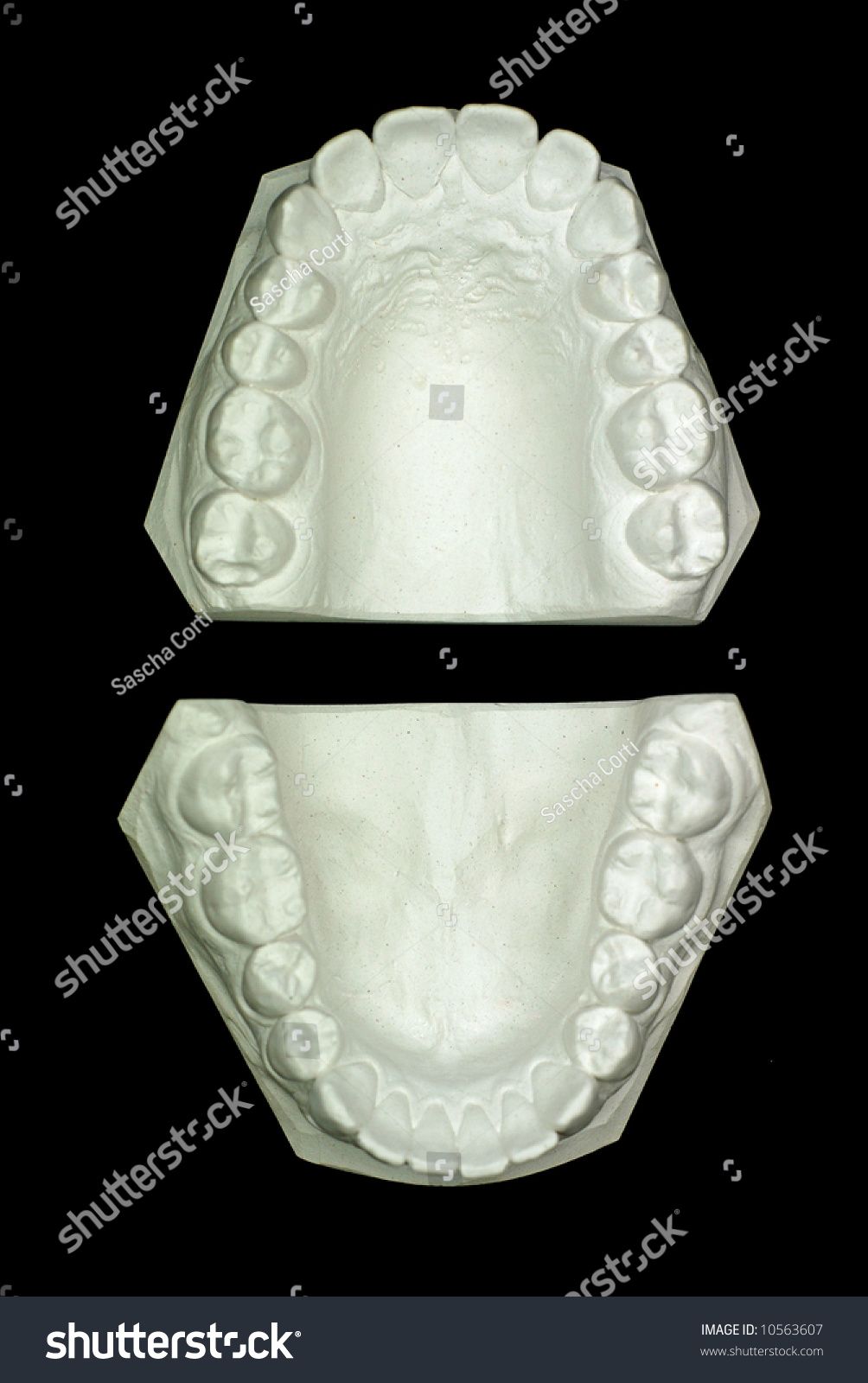 石膏模型石膏牙--上层视图-医疗保健,科学-海洛