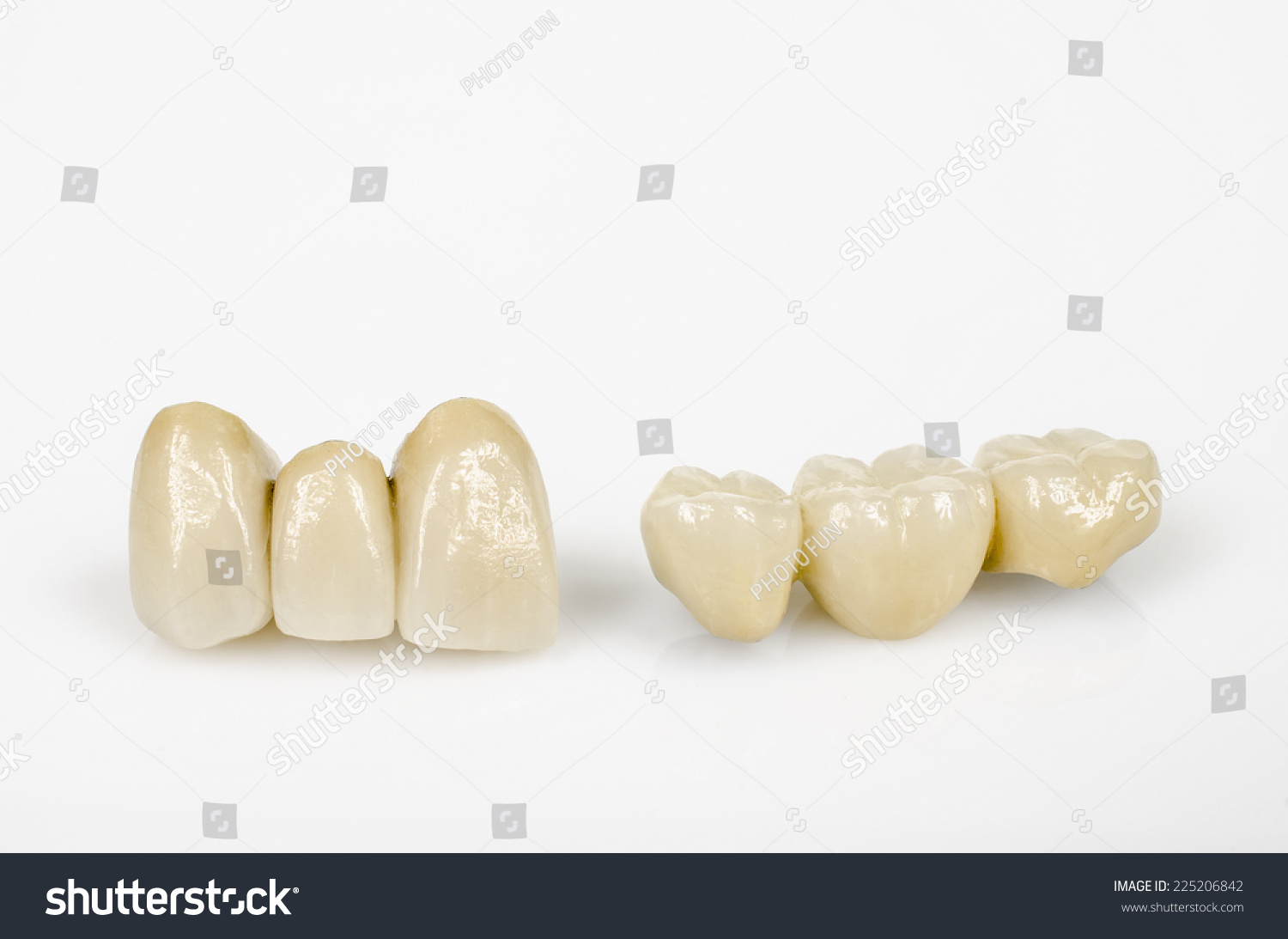 陶瓷门齿和侧牙齿(与金属芯)-医疗保健,物体-海