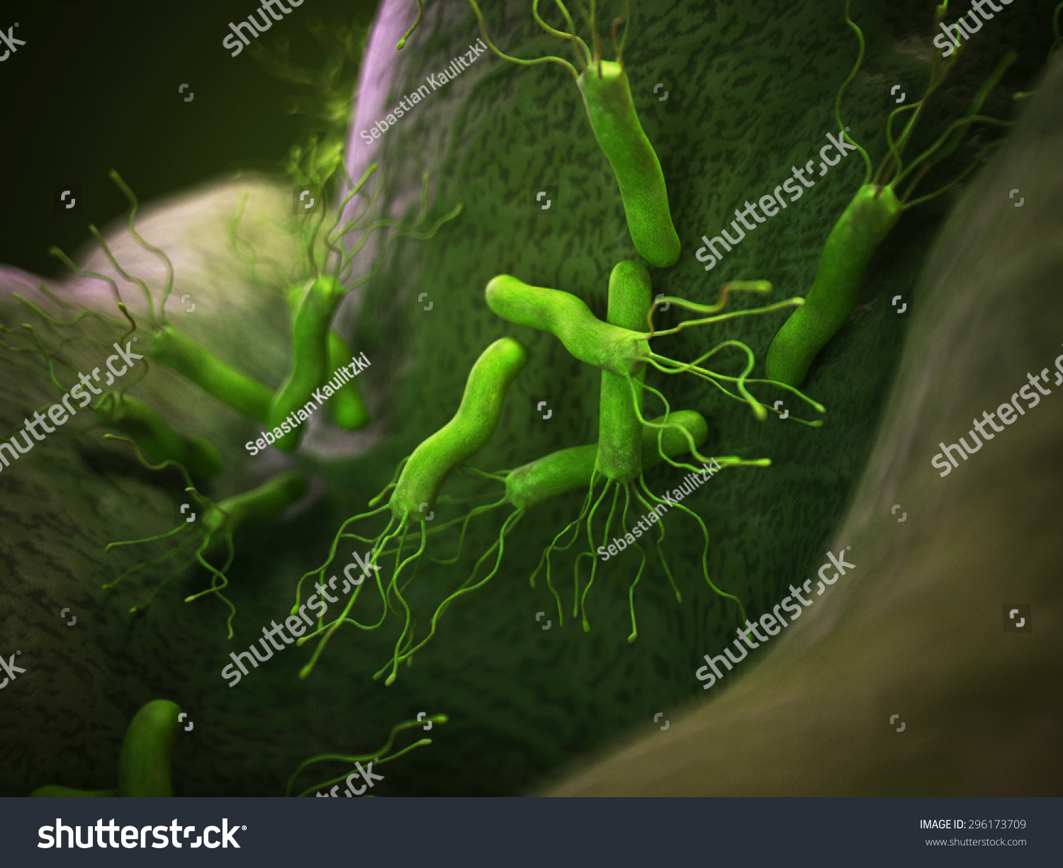 医学细菌幽门螺杆菌的插图-医疗保健,科学-海洛