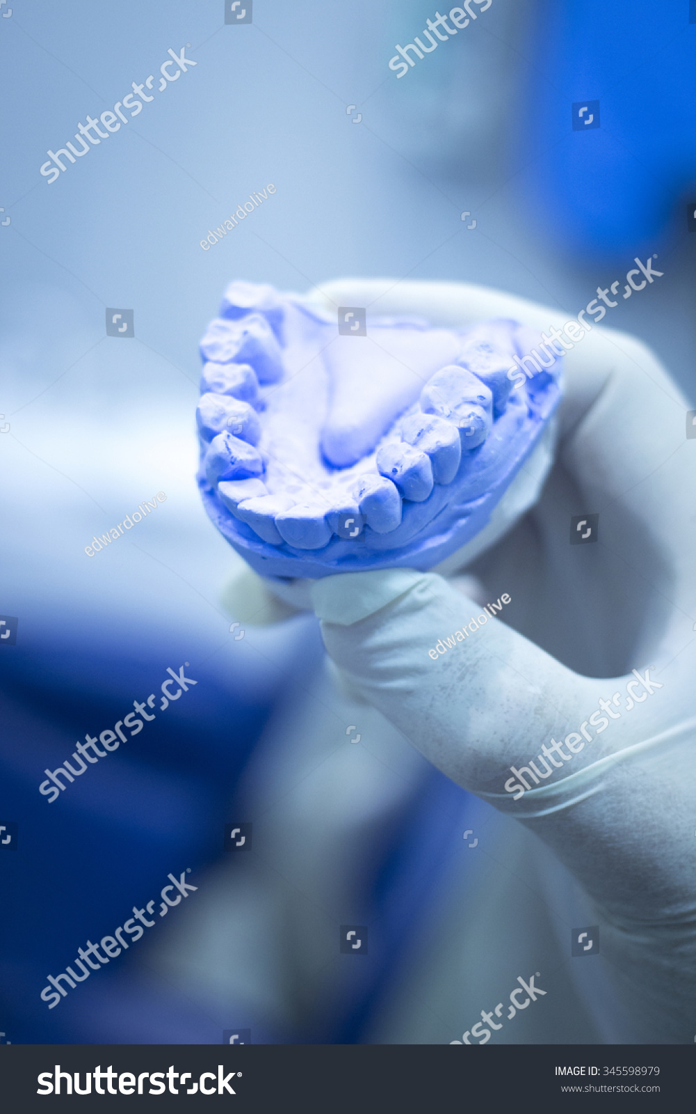 牙模具牙齿牙医粘土板陶瓷铸型模型显示蛀牙牙