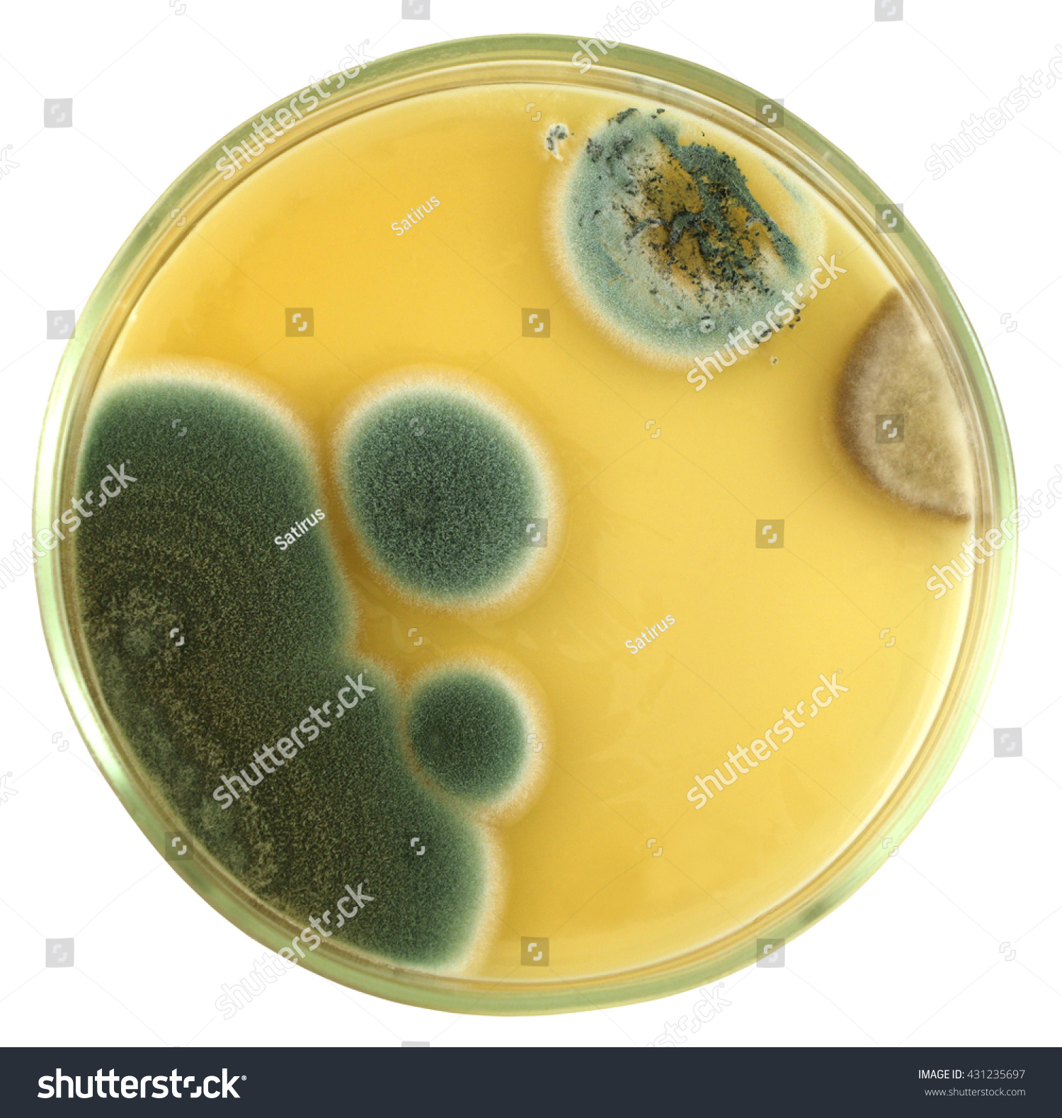 Colonies of allergic mould (genus Penicillium a