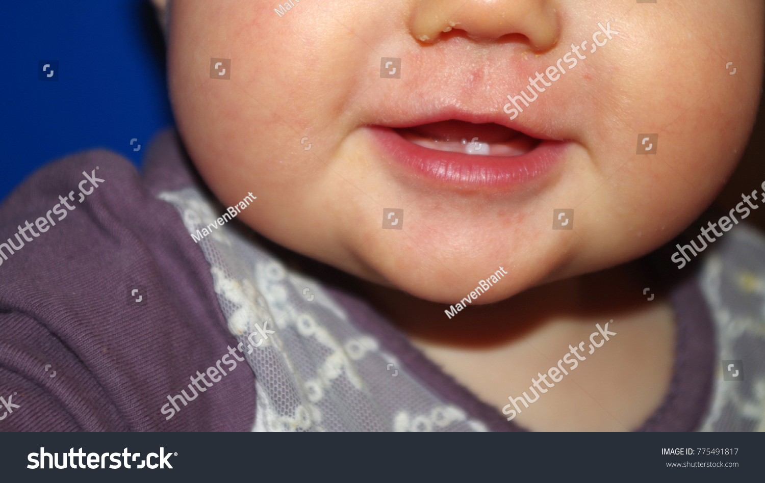 baby with one tooth