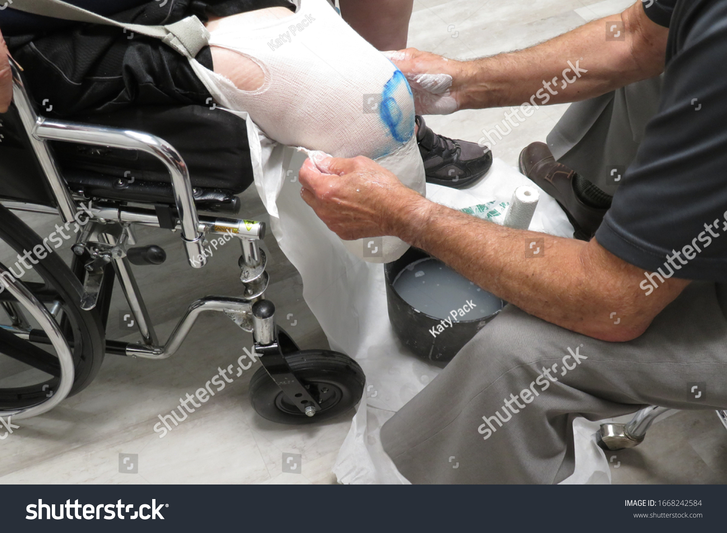 Caucasian Male Prosthetist Wraps Gauze Plaster Stock Photo 1668242584 ...