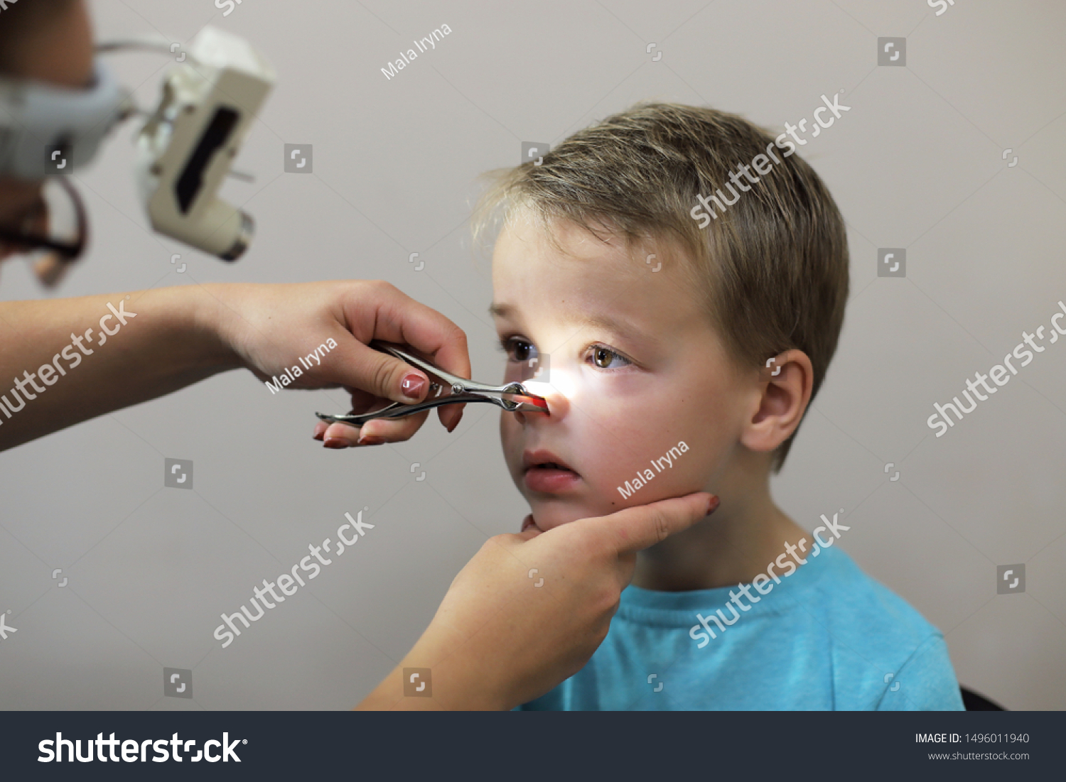 Adenoid Fotografii Imagini I Fotografie De Stoc Shutterstock   Stock Photo A Child With Adenoids At The Reception At The Children S Otolaryngologist In The Hospital Cute Boy 1496011940 