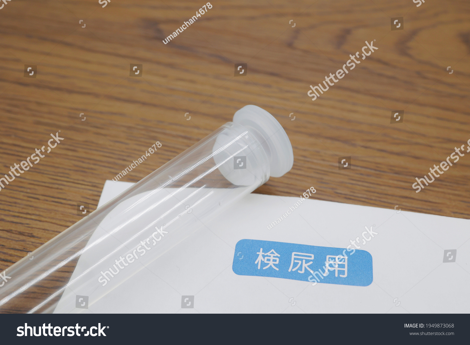 clear-urine-test-container-translation-urinalysis-stock-photo