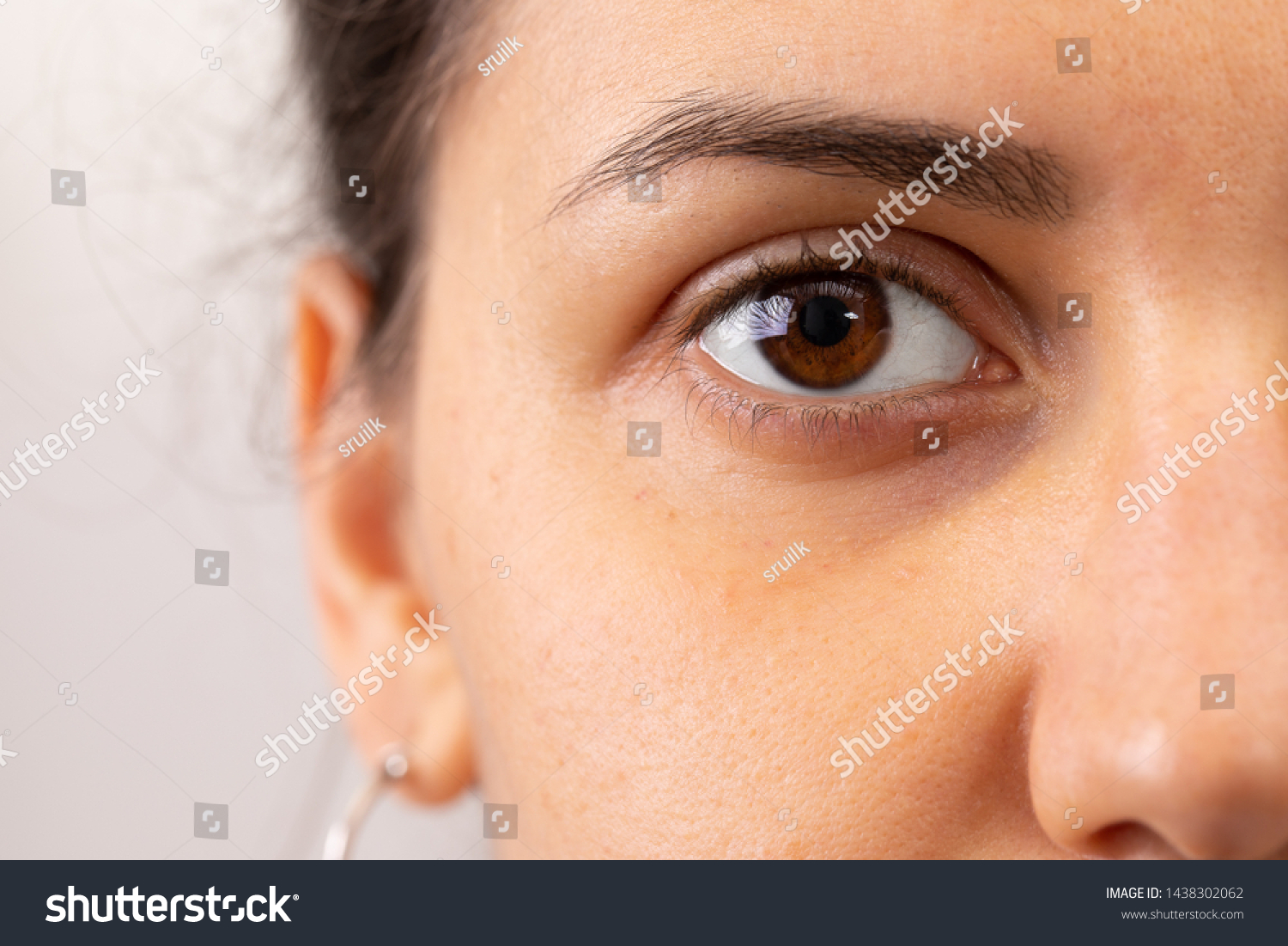 16,135 Women with dark circles Images, Stock Photos & Vectors ...