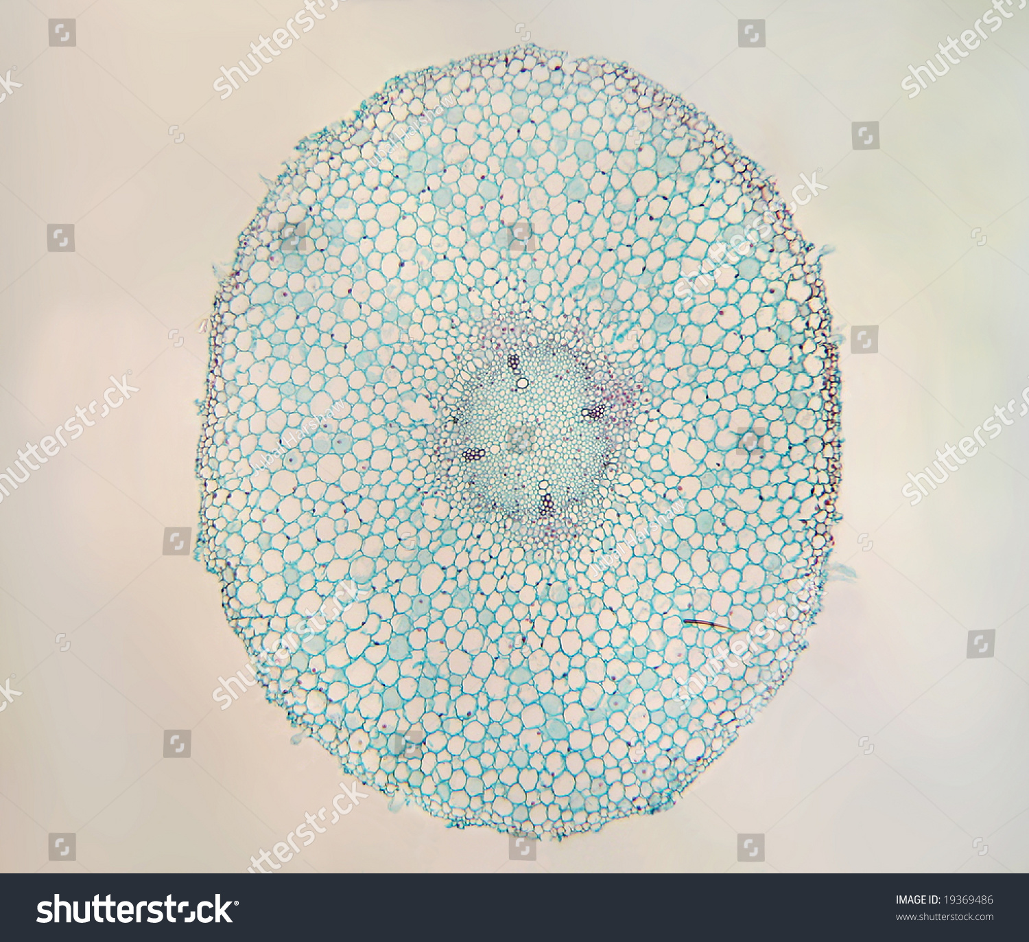 A Cross Section Of The Root Of A Broad Bean (Vicia Faba), 40x Stock ...