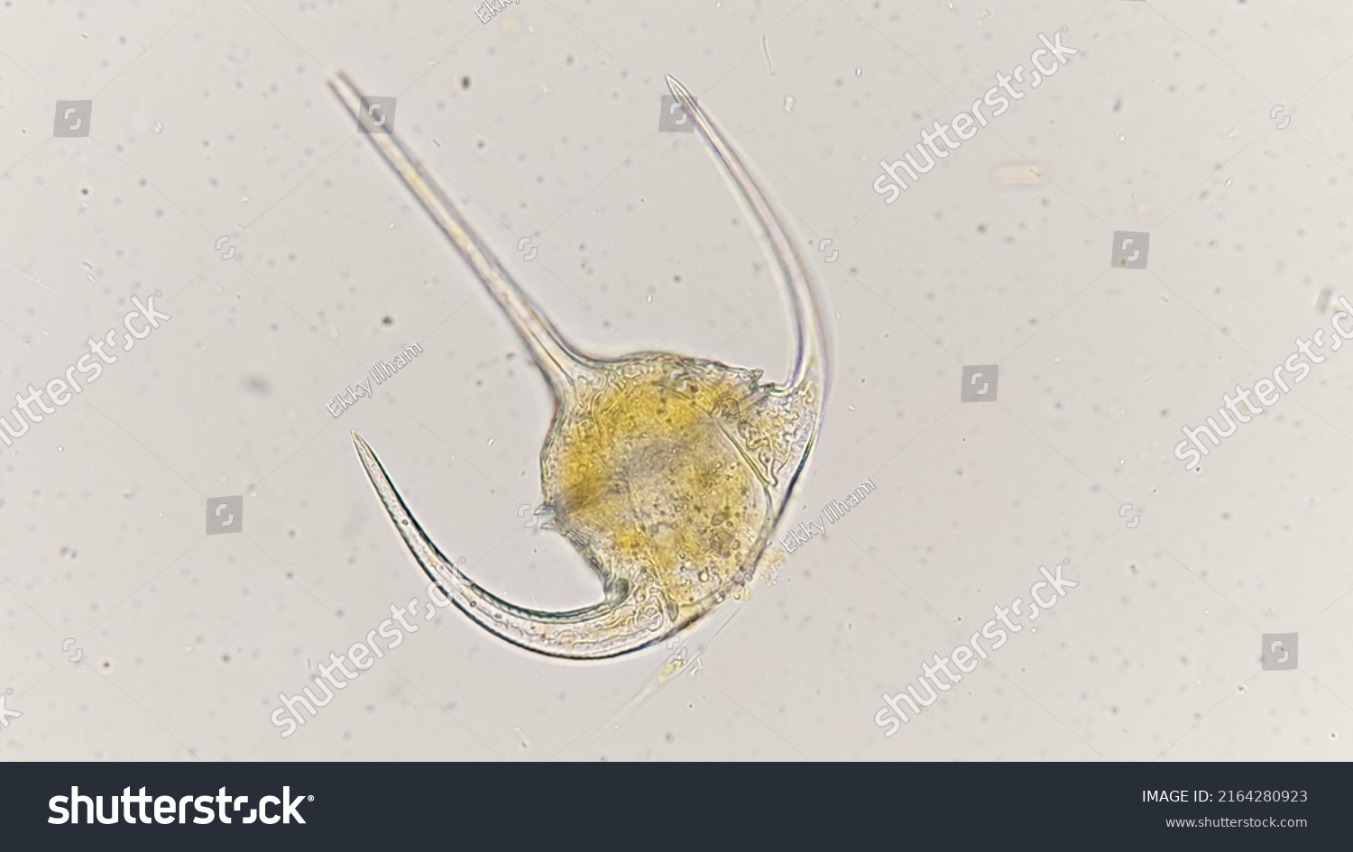 Dinoflagellates Called Ceratium Declinatum Collected Jakarta Stock ...