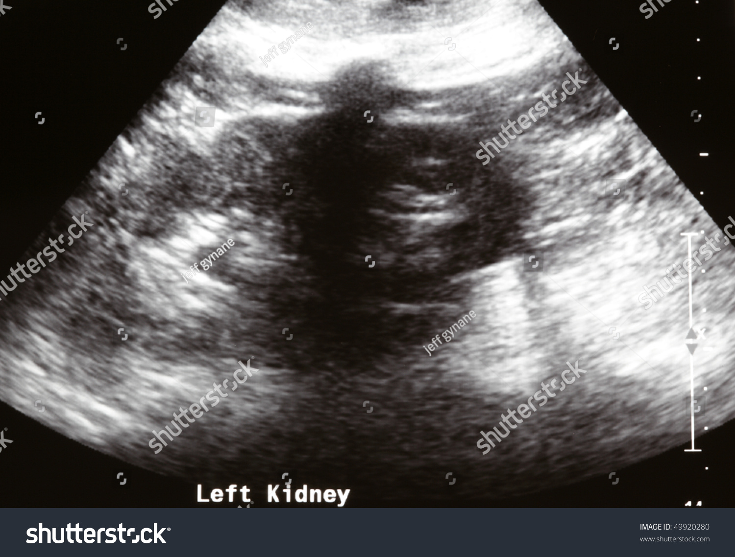 A Hospital Scan Of A Human Kidney Stock Photo 49920280 : Shutterstock