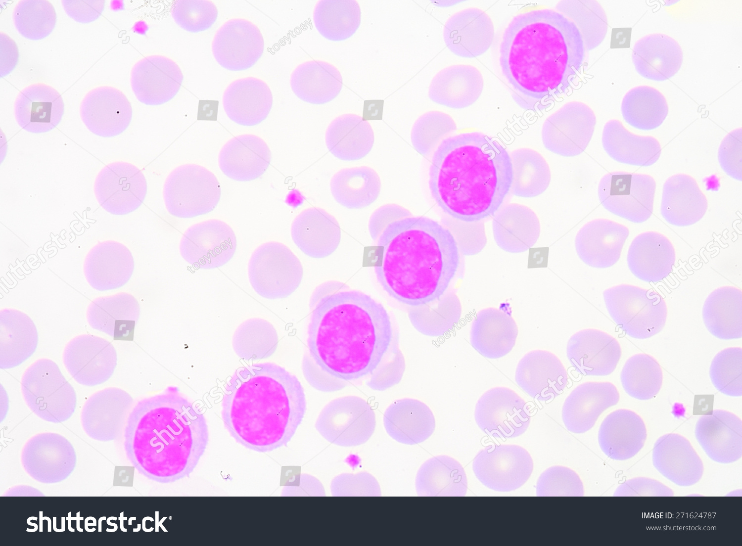 A Lymphocyte Is Any Of Three Subtypes Of White Blood Cell In A ...