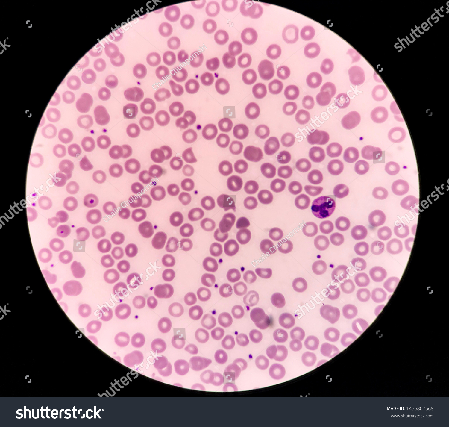 Neutrophil Peripheral Blood Smear Stock Photo (Edit Now) 1456807568