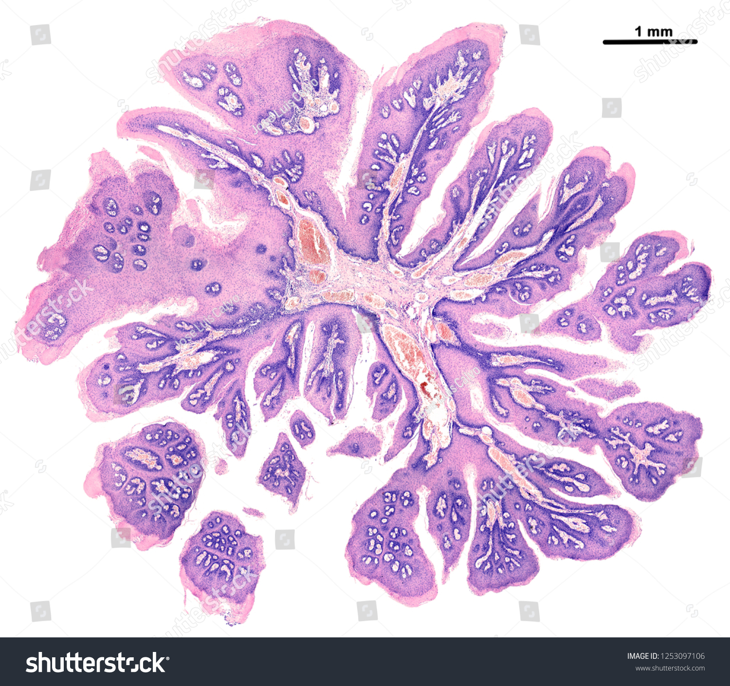 Papillomas fronds, Much more than documents.