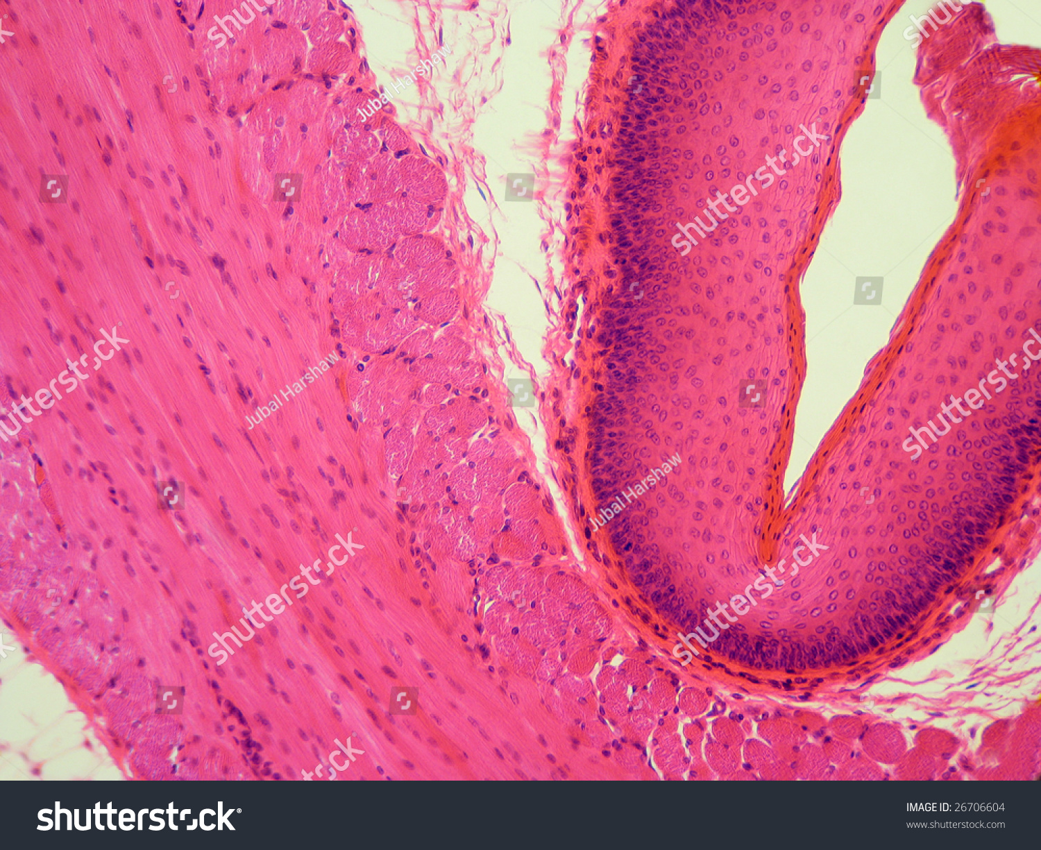 A Portion Of The Esophagus From The Lumen Through Both Muscle Layers ...