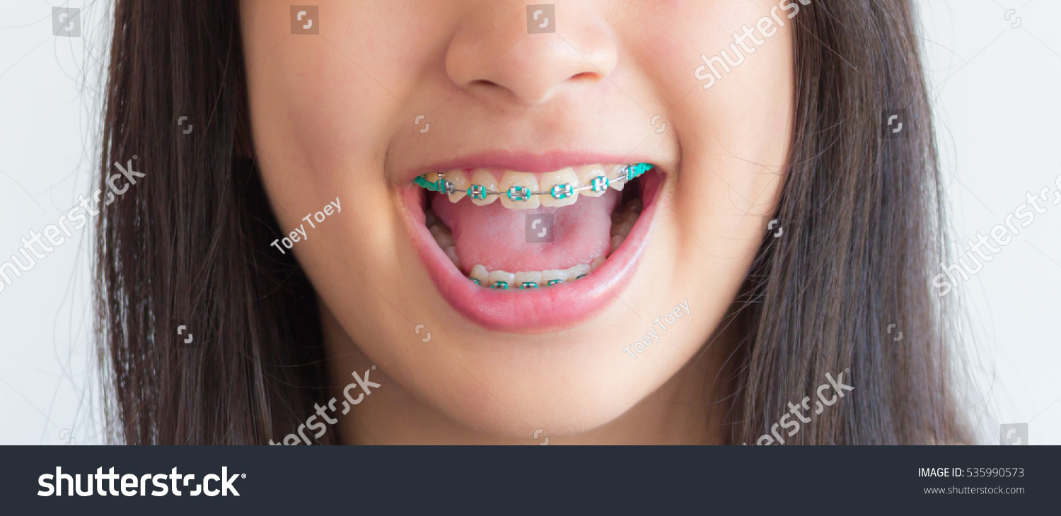 Asian Girl Mouth