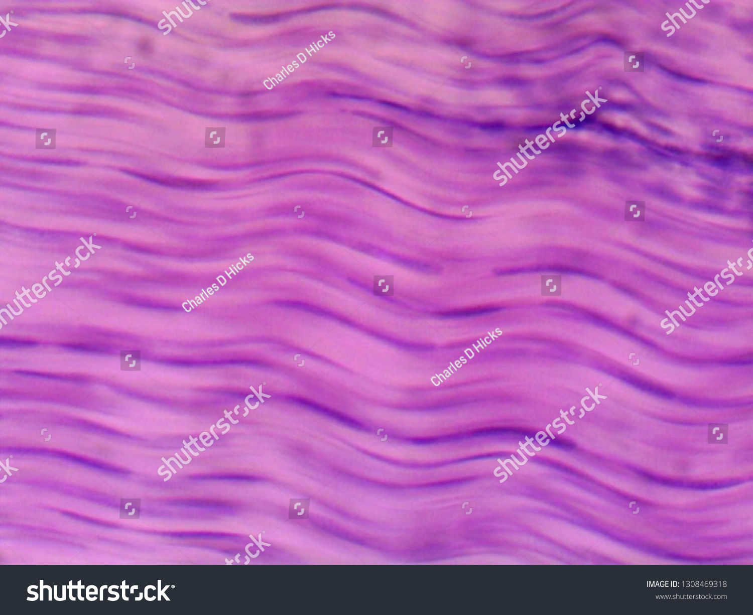8 Dense Regular Connective Tissue Images Stock Photos Vectors 