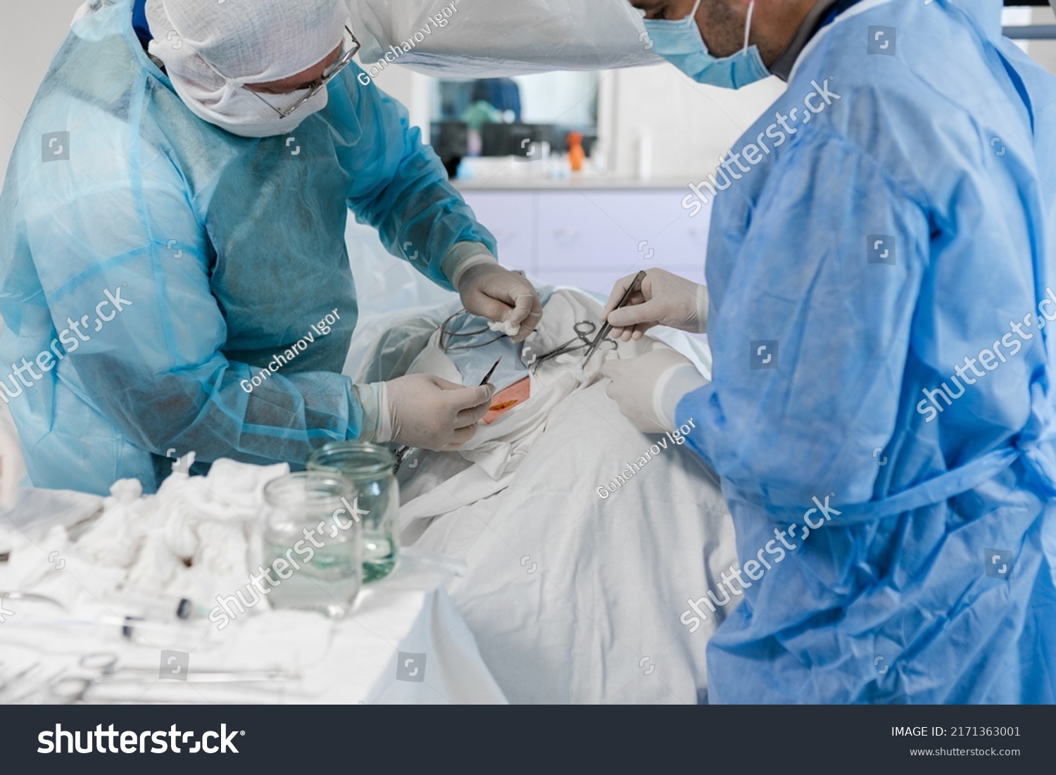 Abdomen Cut Scalpel Surgery Operating Room Stock Photo 2171363001 ...