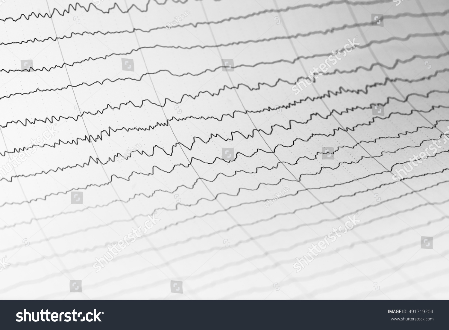 Abnormal Eegbrain Wave On Electroencephalogram Eeg Stock Photo Shutterstock