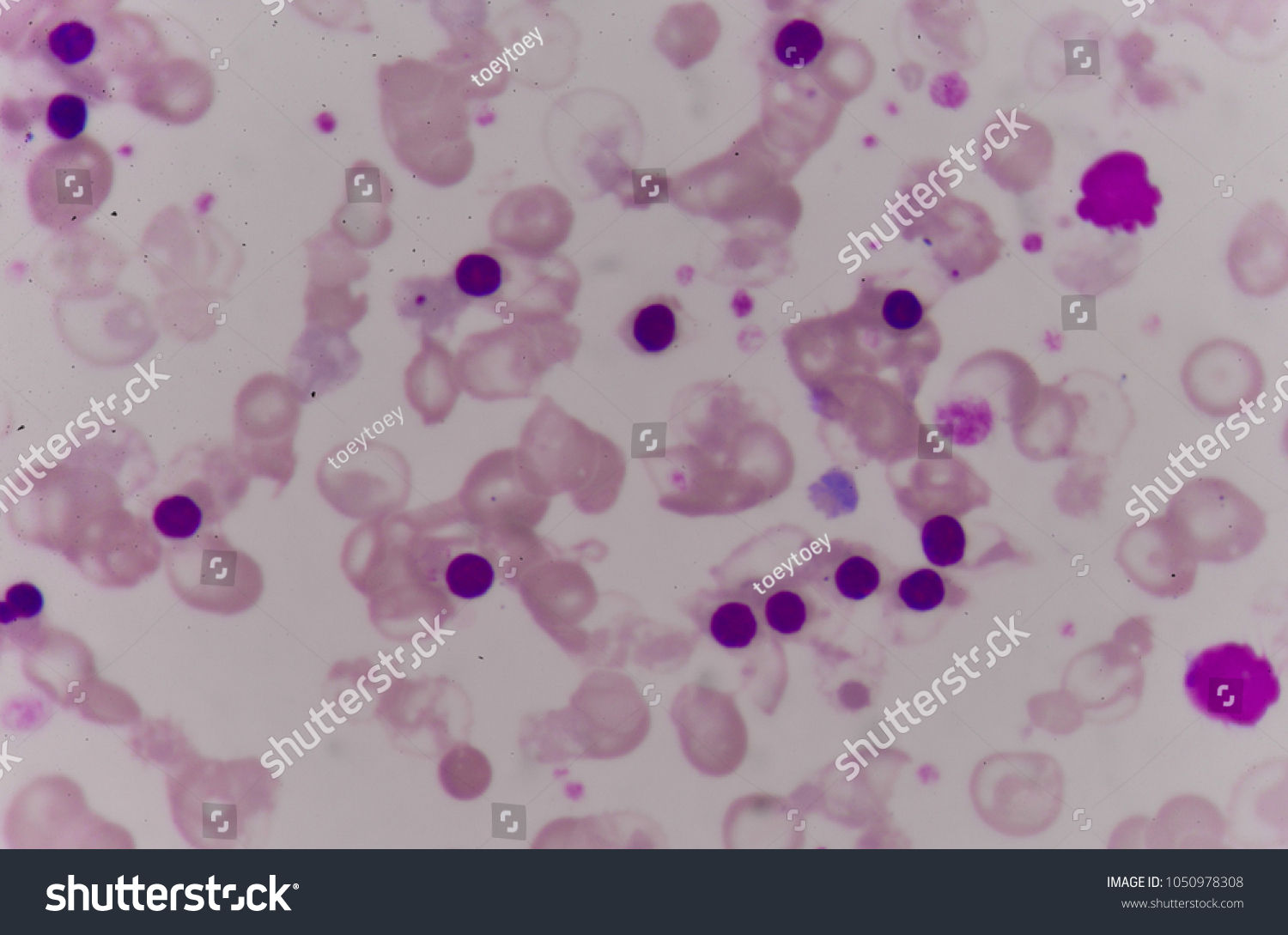 Abnormal Red Blood Cells Blood Smear Stock Photo 1050978308 | Shutterstock